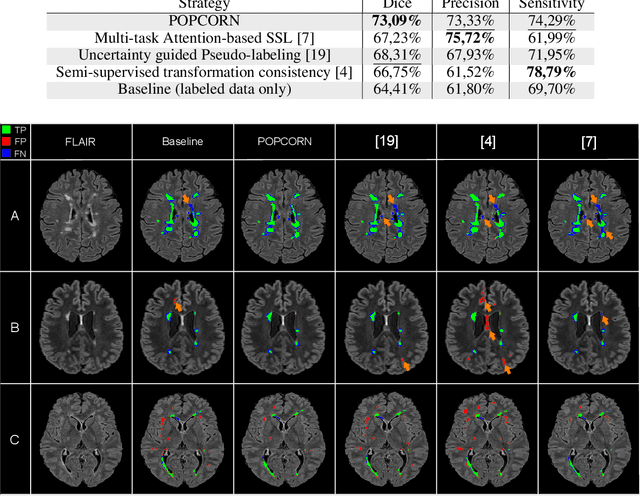 Figure 3 for POPCORN: Progressive Pseudo-labeling with Consistency Regularization and Neighboring