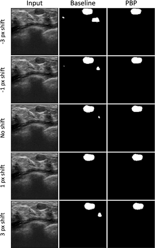 Figure 1 for Investigating Shift-Variance of Convolutional Neural Networks in Ultrasound Image Segmentation