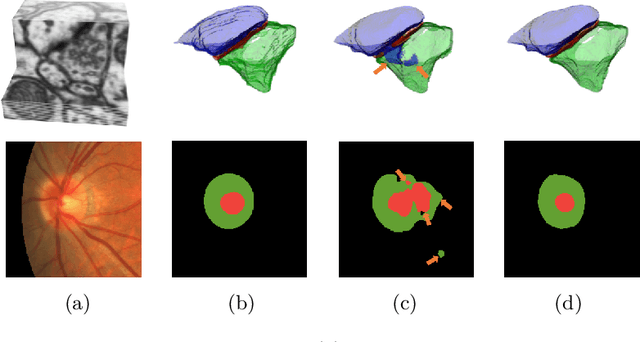 Figure 1 for Probabilistic Atlases to Enforce Topological Constraints