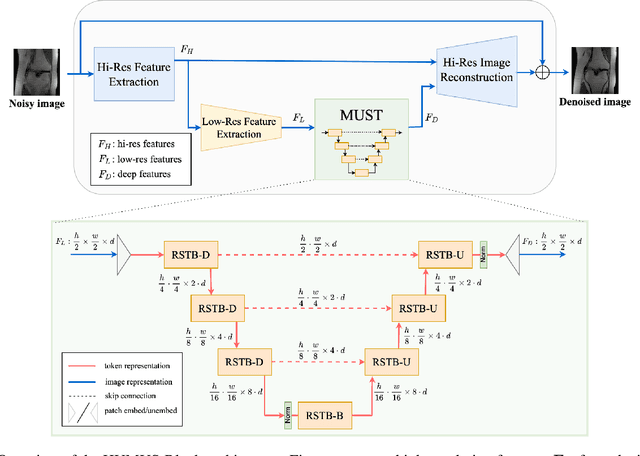 Figure 1 for HUMUS-Net: Hybrid unrolled multi-scale network architecture for accelerated MRI reconstruction
