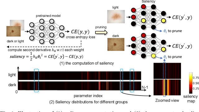 Figure 1 for FairPrune: Achieving Fairness Through Pruning for Dermatological Disease Diagnosis