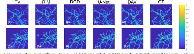 Figure 3 for Deep Learning Adapted Acceleration for Limited-view Photoacoustic Computed Tomography