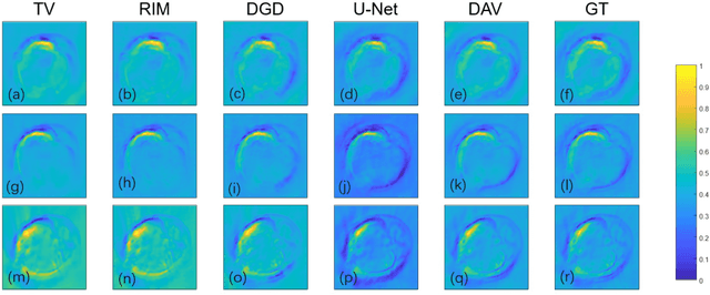 Figure 4 for Deep Learning Adapted Acceleration for Limited-view Photoacoustic Computed Tomography