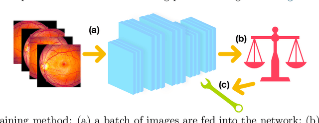 Figure 2 for Learning from few examples: Classifying sex from retinal images via deep learning