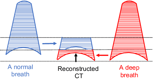 Figure 2 for Geodesic Density Regression for Correcting 4DCT Pulmonary Respiratory Motion Artifacts