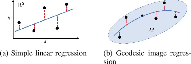Figure 3 for Geodesic Density Regression for Correcting 4DCT Pulmonary Respiratory Motion Artifacts