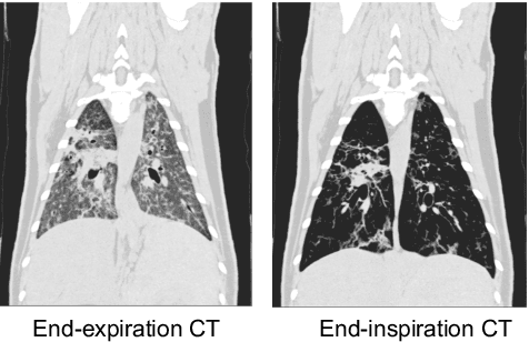 Figure 4 for Geodesic Density Regression for Correcting 4DCT Pulmonary Respiratory Motion Artifacts