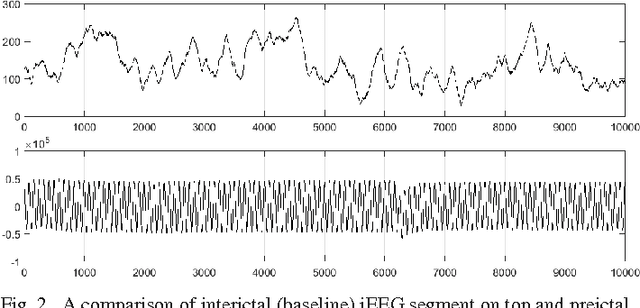 Figure 2 for Cloud-based Deep Learning of Big EEG Data for Epileptic Seizure Prediction