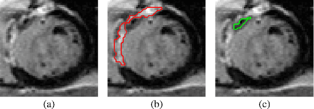 Figure 1 for A Comprehensive 3-D Framework for Automatic Quantification of Late Gadolinium Enhanced Cardiac Magnetic Resonance Images
