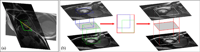 Figure 3 for A Comprehensive 3-D Framework for Automatic Quantification of Late Gadolinium Enhanced Cardiac Magnetic Resonance Images