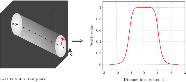 Figure 3 for Extraction of airway trees using multiple hypothesis tracking and template matching