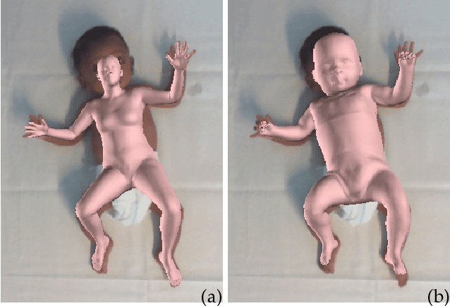 Figure 1 for Learning and Tracking the 3D Body Shape of Freely Moving Infants from RGB-D sequences