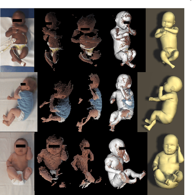 Figure 3 for Learning and Tracking the 3D Body Shape of Freely Moving Infants from RGB-D sequences