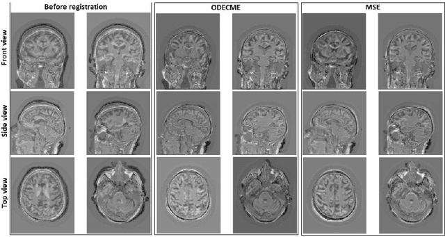 Figure 4 for Ordinary Differential Equation and Complex Matrix Exponential for Multi-resolution Image Registration