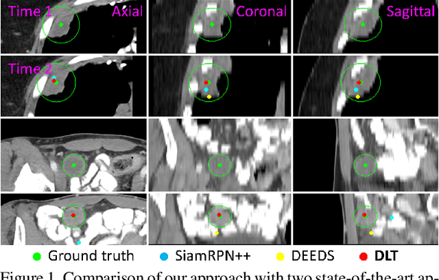 Figure 1 for Deep Lesion Tracker: Monitoring Lesions in 4D Longitudinal Imaging Studies