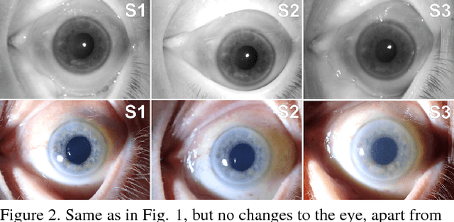 Figure 3 for Post-mortem Human Iris Recognition