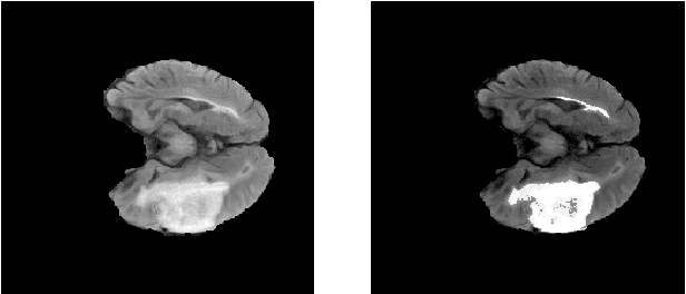 Figure 3 for Region of Interest Identification for Brain Tumors in Magnetic Resonance Images