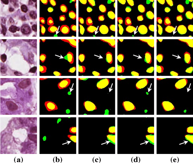 Figure 3 for Label Propagation for Annotation-Efficient Nuclei Segmentation from Pathology Images