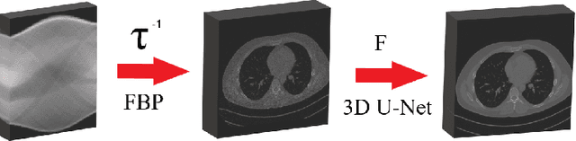 Figure 1 for 3D U-NetR: Low Dose Computed Tomography Reconstruction via Deep Learning and 3 Dimensional Convolutions