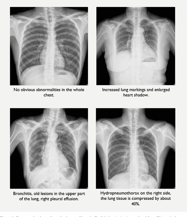 Figure 2 for Automated Radiological Report Generation For Chest X-Rays With Weakly-Supervised End-to-End Deep Learning