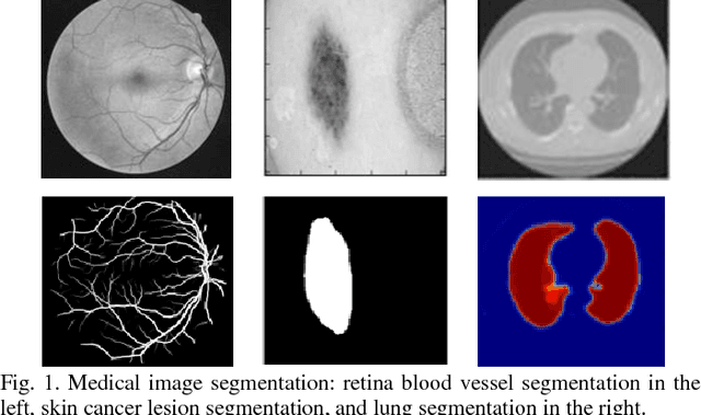 Figure 1 for Recurrent Residual Convolutional Neural Network based on U-Net (R2U-Net) for Medical Image Segmentation