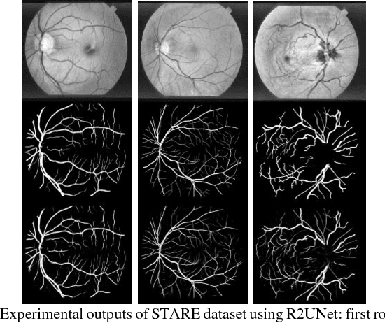 Figure 3 for Recurrent Residual Convolutional Neural Network based on U-Net (R2U-Net) for Medical Image Segmentation