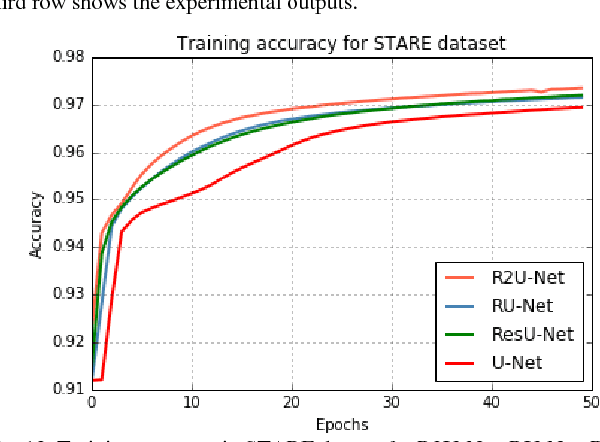 Figure 4 for Recurrent Residual Convolutional Neural Network based on U-Net (R2U-Net) for Medical Image Segmentation