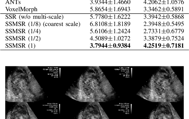 Figure 2 for Test-Time Training for Deformable Multi-Scale Image Registration