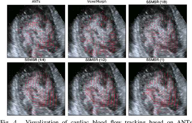 Figure 4 for Test-Time Training for Deformable Multi-Scale Image Registration