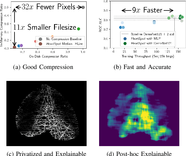 Figure 1 for HeartSpot: Privatized and Explainable Data Compression for Cardiomegaly Detection