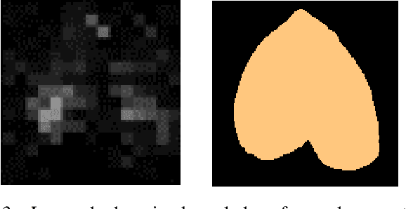 Figure 3 for HeartSpot: Privatized and Explainable Data Compression for Cardiomegaly Detection
