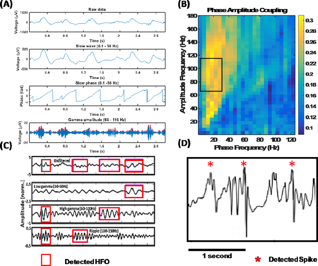 Figure 3 for Integrating Artificial Intelligence with Real-time Intracranial EEG Monitoring to Automate Interictal Identification of Seizure Onset Zones in Focal Epilepsy