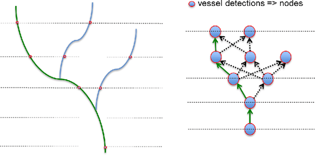 Figure 1 for Automatic tracking of vessel-like structures from a single starting point