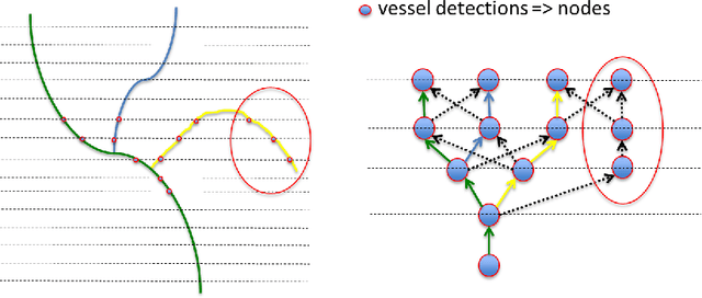 Figure 3 for Automatic tracking of vessel-like structures from a single starting point