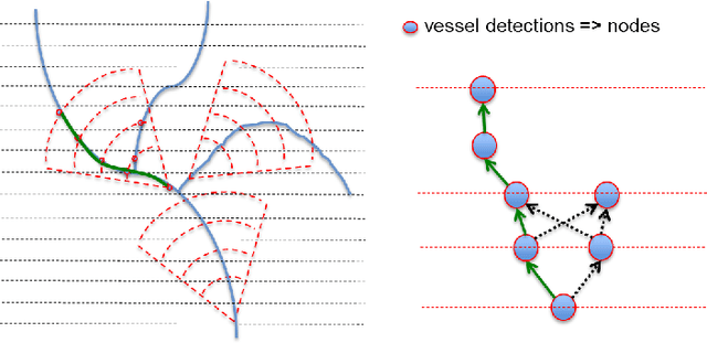 Figure 4 for Automatic tracking of vessel-like structures from a single starting point