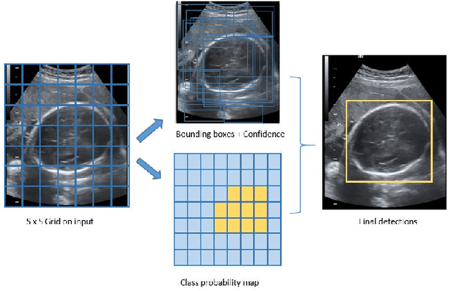 Figure 1 for Fetal Head and Abdomen Measurement Using Convolutional Neural Network, Hough Transform, and Difference of Gaussian Revolved along Elliptical Path (Dogell) Algorithm