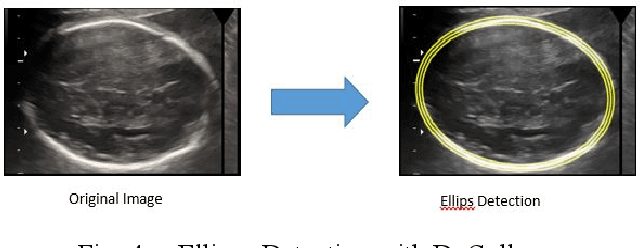Figure 4 for Fetal Head and Abdomen Measurement Using Convolutional Neural Network, Hough Transform, and Difference of Gaussian Revolved along Elliptical Path (Dogell) Algorithm