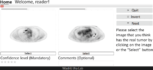 Figure 3 for An estimation-based method to segment PET images