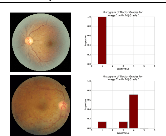 Figure 3 for Direct Uncertainty Prediction for Medical Second Opinions