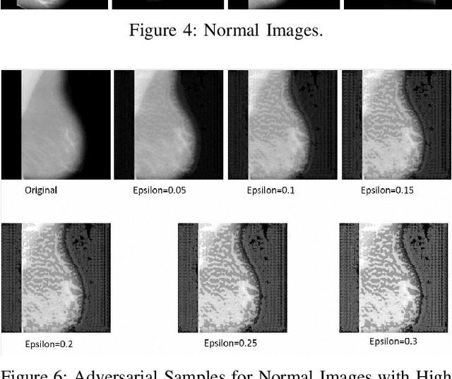 Figure 3 for Practical Fast Gradient Sign Attack against Mammographic Image Classifier
