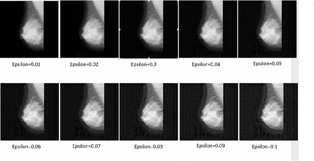 Figure 4 for Practical Fast Gradient Sign Attack against Mammographic Image Classifier