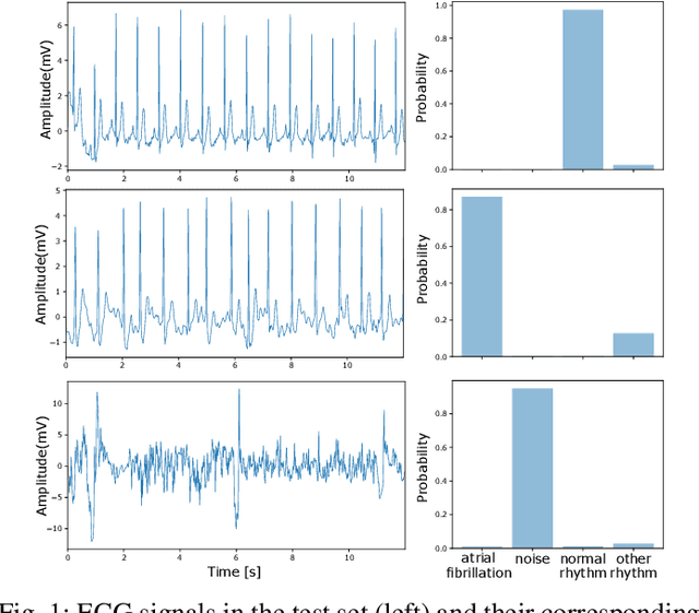 Figure 1 for Convolutional-Recurrent Neural Networks on Low-Power Wearable Platforms for Cardiac Arrhythmia Detection