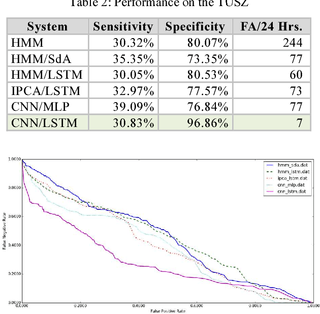 Figure 4 for Deep Architectures for Automated Seizure Detection in Scalp EEGs
