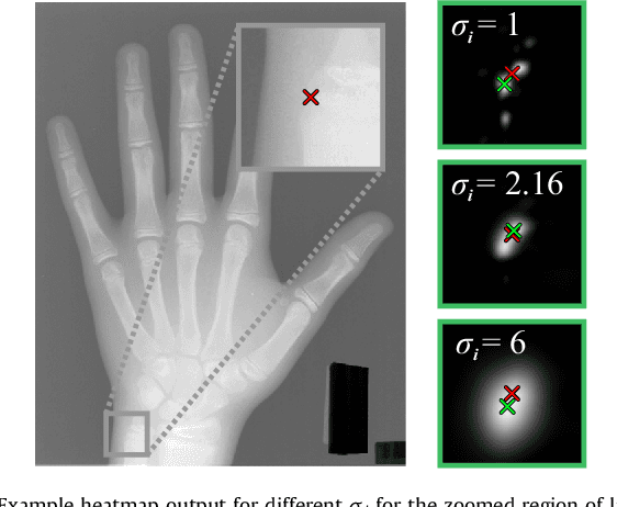Figure 3 for Integrating Spatial Configuration into Heatmap Regression Based CNNs for Landmark Localization