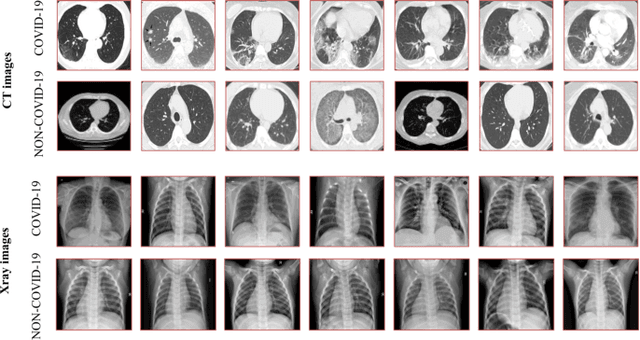 Figure 1 for Deep Radiomic Analysis for Predicting Coronavirus Disease 2019 in Computerized Tomography and X-ray Images