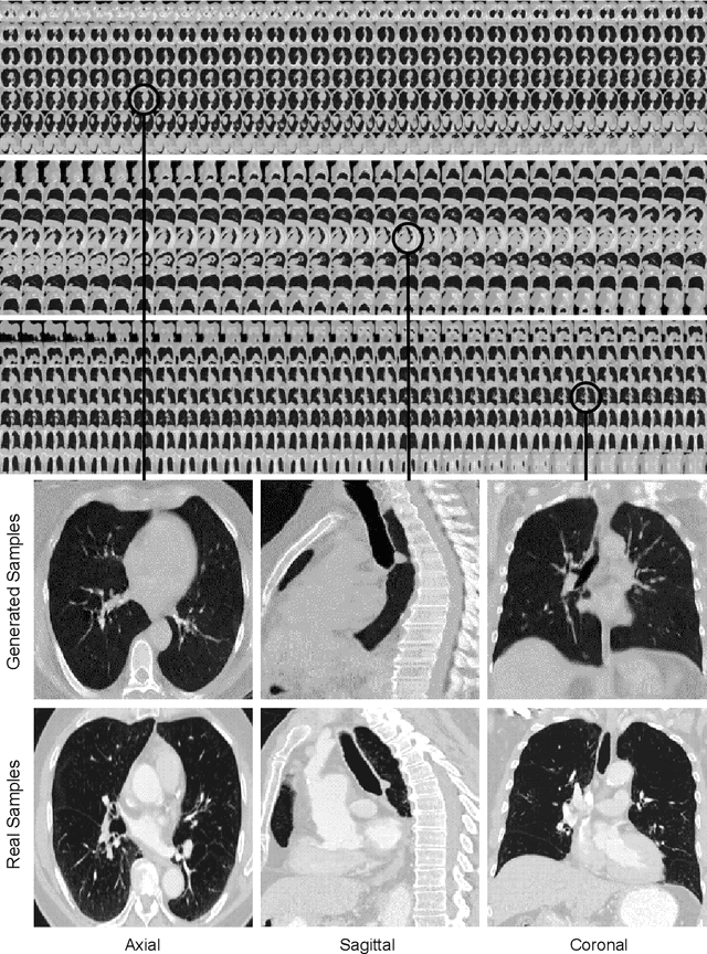 Figure 1 for CT-SGAN: Computed Tomography Synthesis GAN