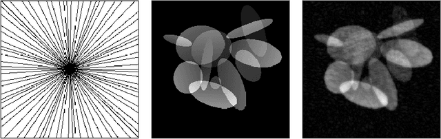 Figure 3 for Localized adversarial artifacts for compressed sensing MRI