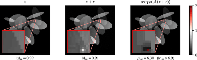 Figure 4 for Localized adversarial artifacts for compressed sensing MRI