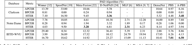 Figure 3 for Iris Presentation Attack Detection by Attention-based and Deep Pixel-wise Binary Supervision Network