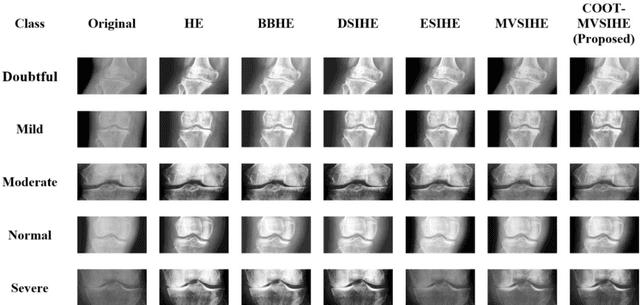 Figure 4 for Sub-Image Histogram Equalization using Coot Optimization Algorithm for Segmentation and Parameter Selection